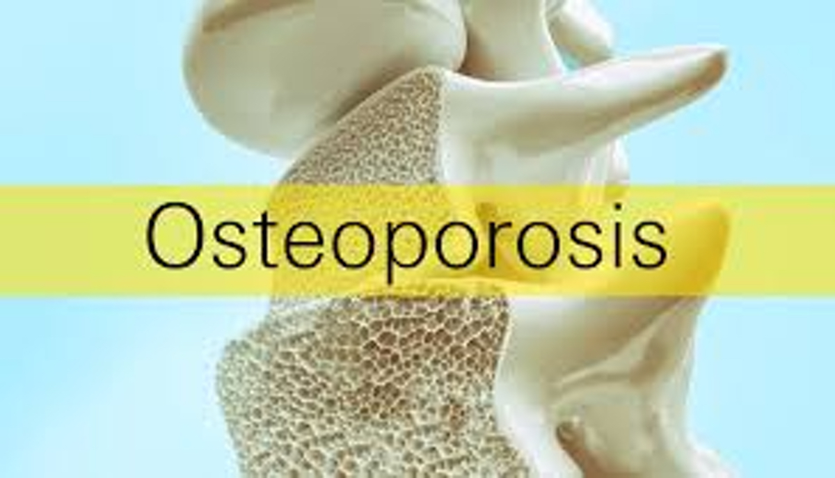 Body Dynamics: Osteoporosis